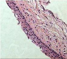 Pathology Image