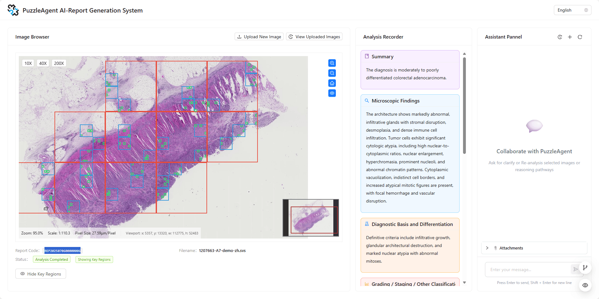 Multi-Agent Interactive Report Generation System